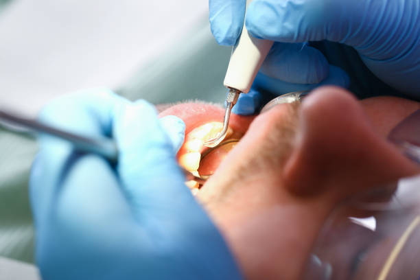 Best Emergency Dental Care for Sports Injuries in Tremont, PA